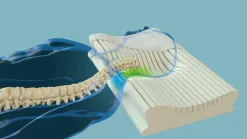 New Nackenstützkissen NECKPROTECT Nackenstützkissen|Kissen